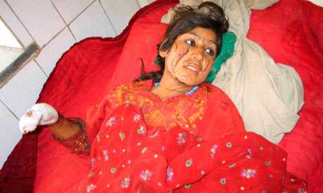 An Afghan girl lies on a hospital bed in Helmand after being injured in an airstrike by coalition forces in June 2007. Photograph: Abdul Qodus/Reuters An Afghan girl lies on a hospital bed in Helmand after being injured in an airstrike by coalition forces in June 2007. Photograph: Abdul Qodus/Reuters