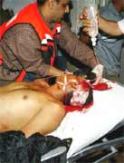 One of around eight Palestinians killed or injured in what Israeli media are characterising as 'a mistake'.